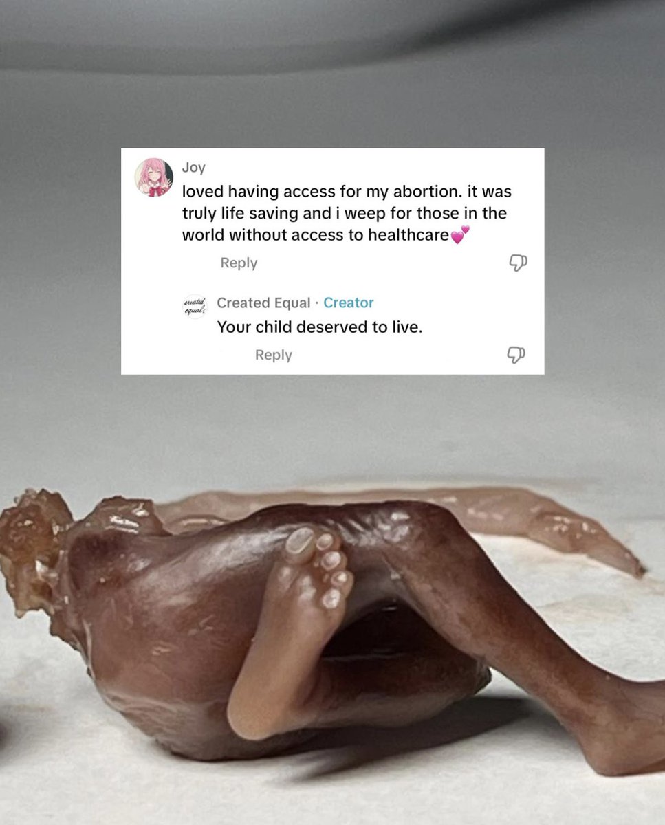 createdequalorg's tweet image. Preborn people should be protected from violence.

#preborn #prebornlivesmatter #antiabortion