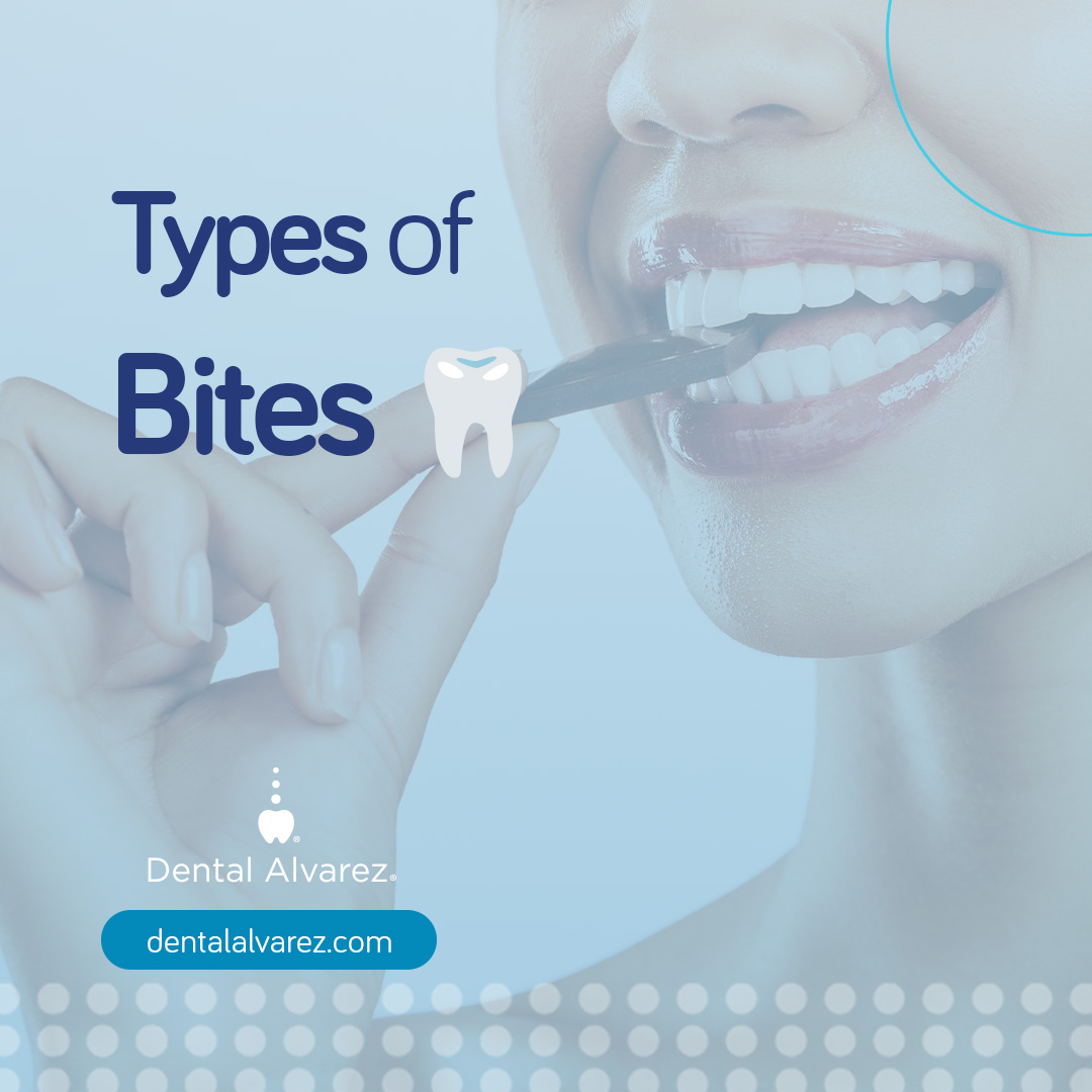 DentalAlvarez's tweet image. Common bite issues include:
Open bite: teeth don't meet properly 🌟
Crossbite: misalignment of upper and lower teeth 🔄
Deep overbite: excessive overlap of teeth 📏

☎️ Book  with us!
US: (619) 734 0233
MX: (664) 900 7282
WhatsApp: (664) 303 1284

#BiteIssues #OrthodonticCare