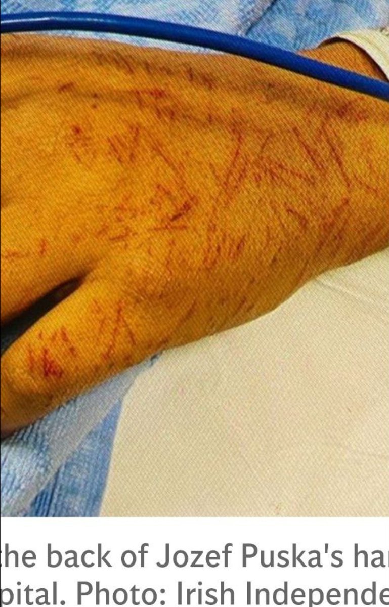 Never forget...

Never forget how hard Ashling Murphy fought for her life using her only defence; a set of keys (see image of Puska's hand). How could she win against someone who was armed with intent to kill and a knife?

Never forget how Jozef Puska  was convicted of rape and