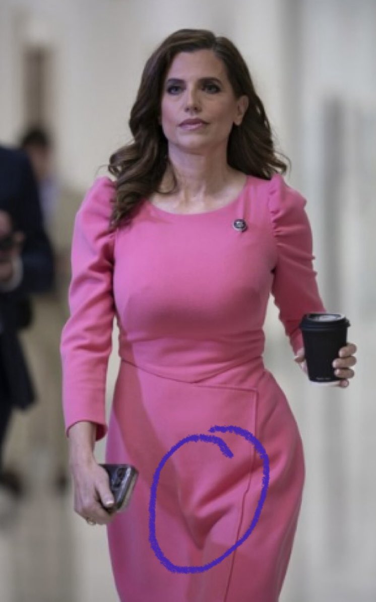 MrGlenCarroll's tweet photo. @TravelinTess1 @NancyMace She posted that thinking she’s hot! She’s probably just happy that her fucking herpes weren’t flaring up again! People are saying that she actually has a penis now. They posted the proof and here it is. #Herpes #Liverspots #CitadelDEI #BathroomGenitaliaMonitor #FakeRapeStory https://t.co/9SKXr0sOw9
