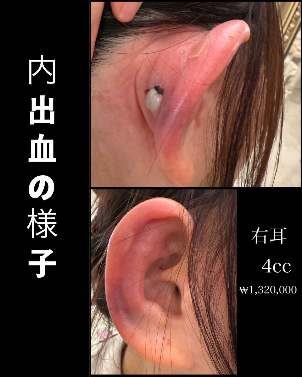 micax🐸整形垢 (@micax327) / Posts / X