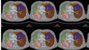 Radiology_AI's tweet photo. A method for post-hoc compression of TotalSegmentator https://t.co/Sd4DqGhUk8 @LMU_Radiology #TotalSegmentator #RadCT #MachineLearning https://t.co/GuX0JEUxwJ