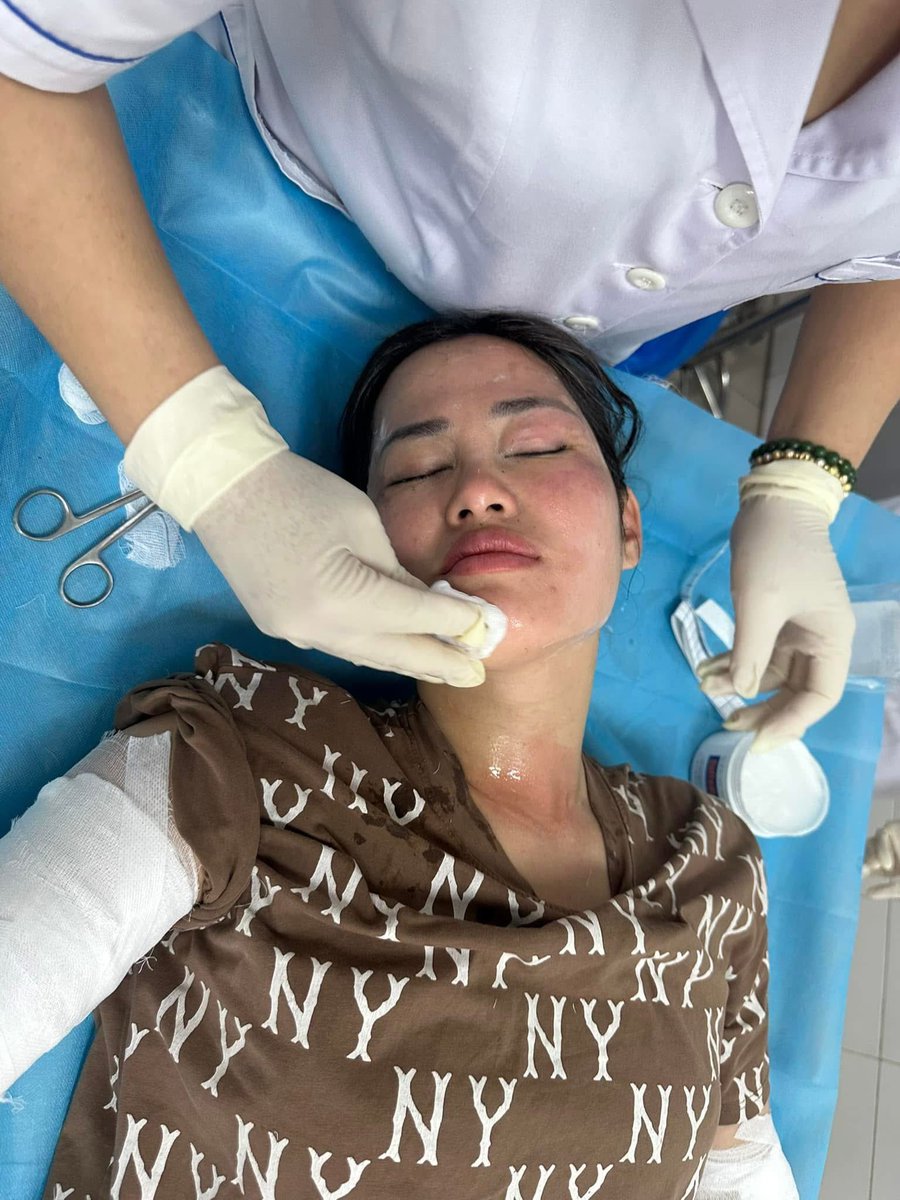 Mr_Whathapened's tweet image. เหตุเกิดที่เวียดนาม ลูกโป่งอัดแก้สไฮโดรเจนระเบิดขณะกำลังอวยพรวันเกิดเลย จำได้เมื่อหลายปีก่อนเคยมีอุบัติเหตุเกี่ยวกับลูกโป่งอัดไฮโดรเจน  ตั้งแต่นั้นมีการเปลี่ยนไปใช้ฮีเลี่ยมแล้วทำไมยังกลับมาใช้ไฮโดรเจนอีกประมาทจริงๆ