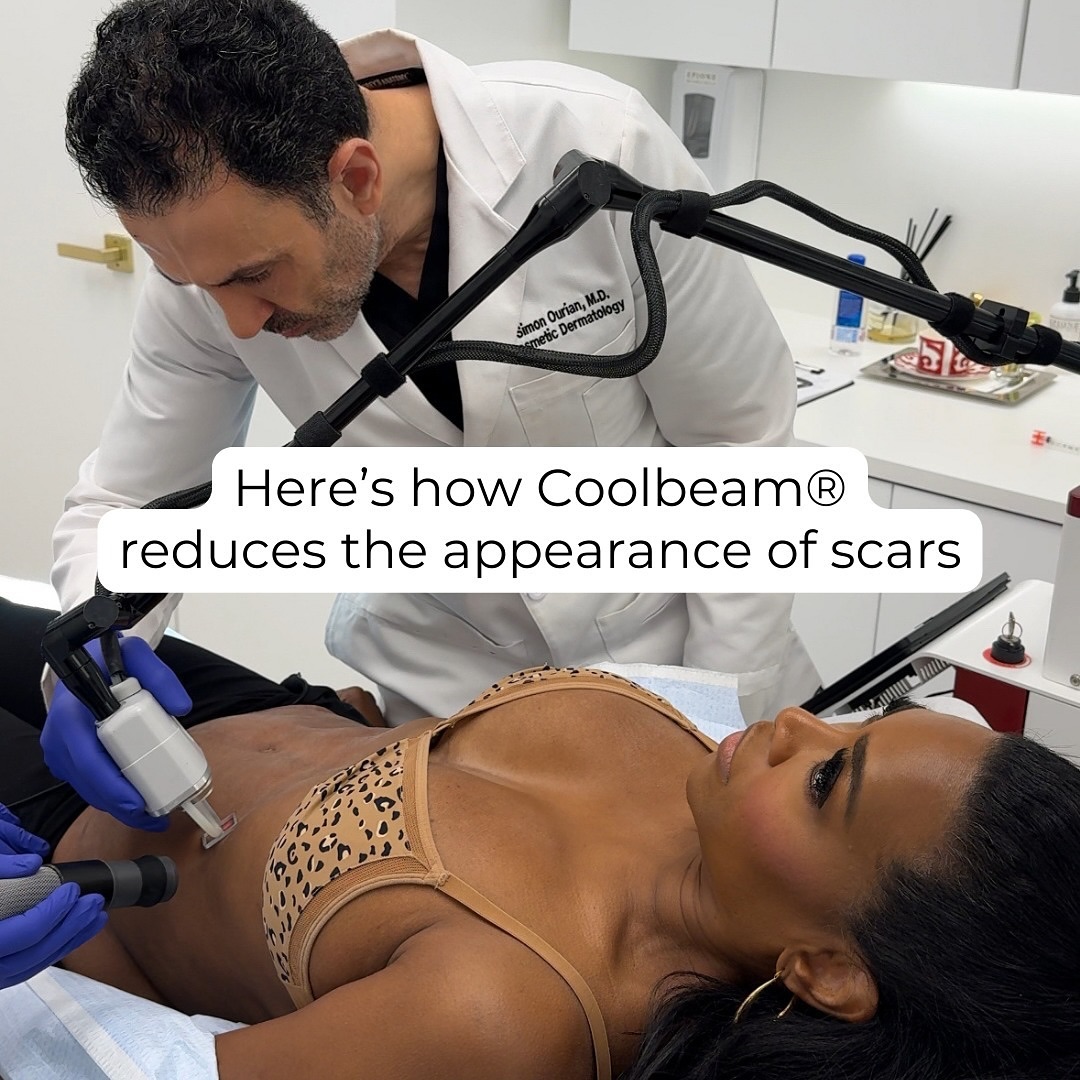 simonourianmd's tweet photo. Ready for your own transformation? Visit https://t.co/iQtAoLLEW7 for your treatment options.

#scarreduction #scars #coolbeam #coolbeamlaser https://t.co/IQEtPv1gIl