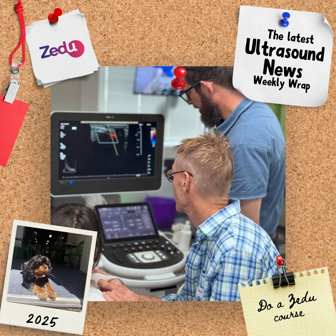 Zedu Ultrasound Training @zedunow@med-mastodon.com (@zedunow) on Twitter photo Get the best in latest free #ultrasound news in the Weekly Wrap
🔥Featuring
<a href="/POCUSJournal/">POCUS Journal</a>
<a href="/MH_EMultrasound/">MetroHealth Emergency Ultrasound</a>
<a href="/yaletung/">Yale Tung-Chen</a>
<a href="/cardiacACCP/">ℍ𝕒𝕟𝕟𝕒𝕙 ℂ𝕠𝕟𝕨𝕒𝕪</a>
<a href="/xworts/">Ximena Wortsman</a>
👇For this and more
ultrasoundtraining.com.au/news/zedu-week…
#POCUS #ultrasoundtraining Get the best in latest free #ultrasound news in the Weekly Wrap
🔥Featuring
<a href="/POCUSJournal/">POCUS Journal</a>
<a href="/MH_EMultrasound/">MetroHealth Emergency Ultrasound</a>
<a href="/yaletung/">Yale Tung-Chen</a>
<a href="/cardiacACCP/">ℍ𝕒𝕟𝕟𝕒𝕙 ℂ𝕠𝕟𝕨𝕒𝕪</a>
<a href="/xworts/">Ximena Wortsman</a>
👇For this and more
ultrasoundtraining.com.au/news/zedu-week…
#POCUS #ultrasoundtraining