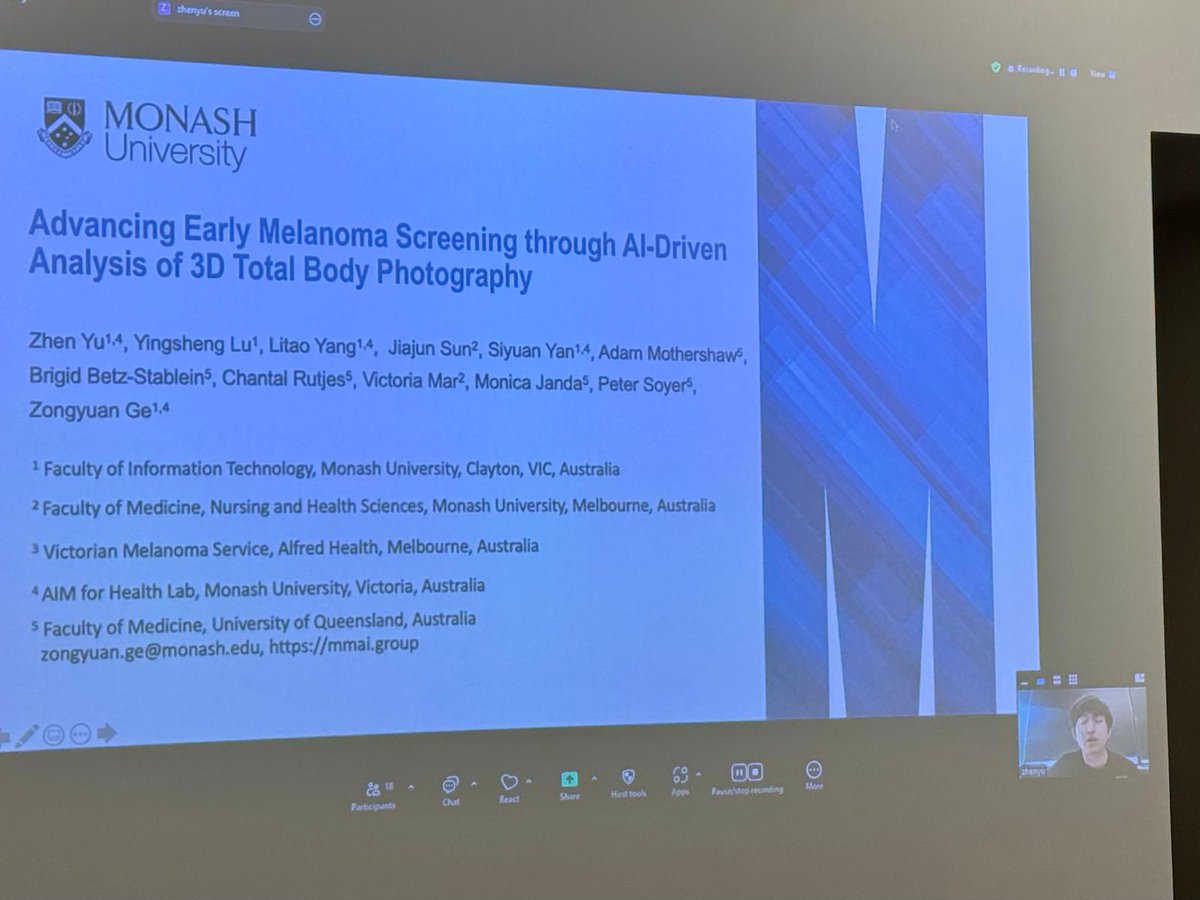 🗣 Session 3, "Synergy Grant session", covered some of the projects funded by the Synergy Grant. These include projects about trust in AI, AI for lesion detection and a projects about melanoma risk assessment tools.