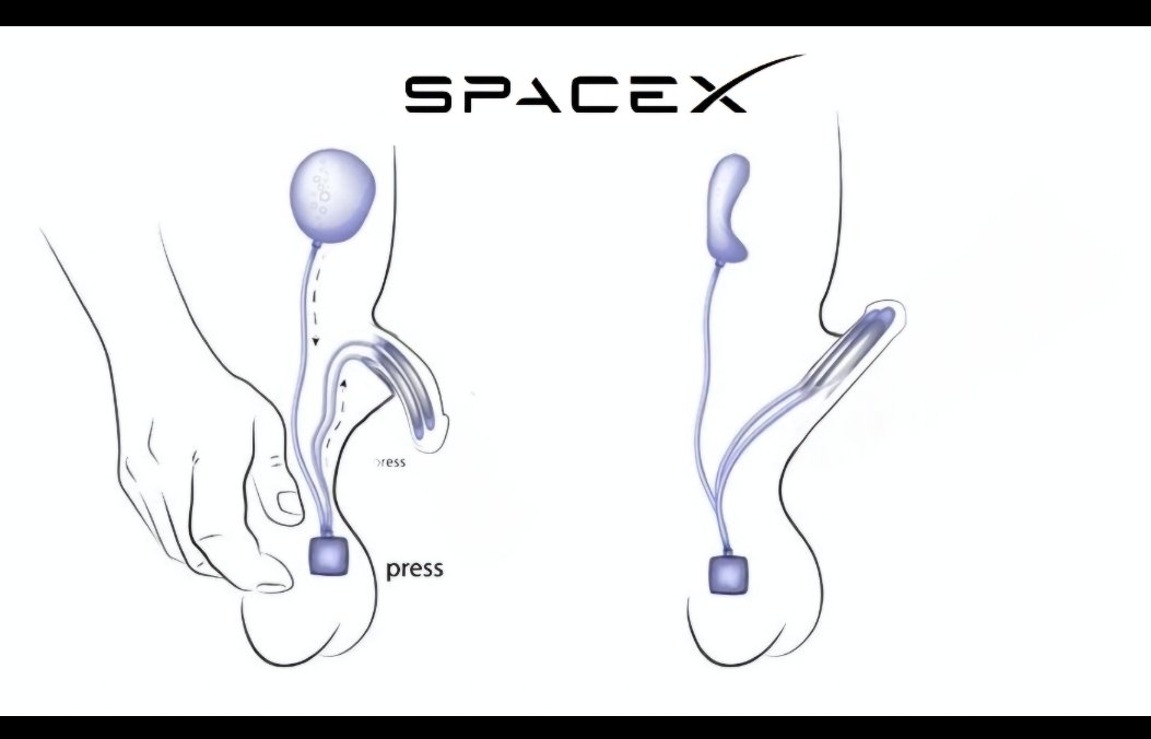 theliamnissan's tweet photo. found the blueprints for Elon's broken penis implant https://t.co/3NBjnuLnCW