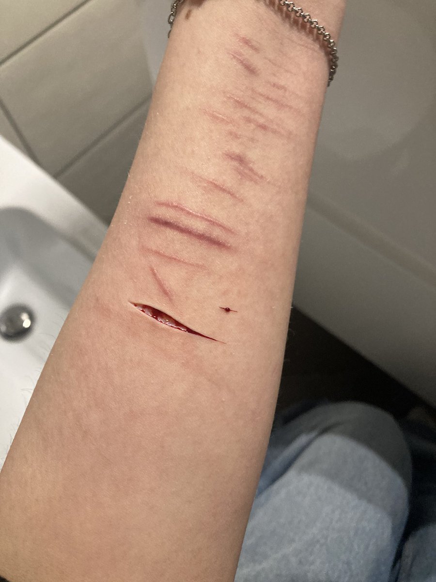 SubmissivAngel's tweet photo. one swipe deep cut , can someone tell me how much deep it is??? pls #shtwt #oneswipe #sh https://t.co/V6ejlaTZFc