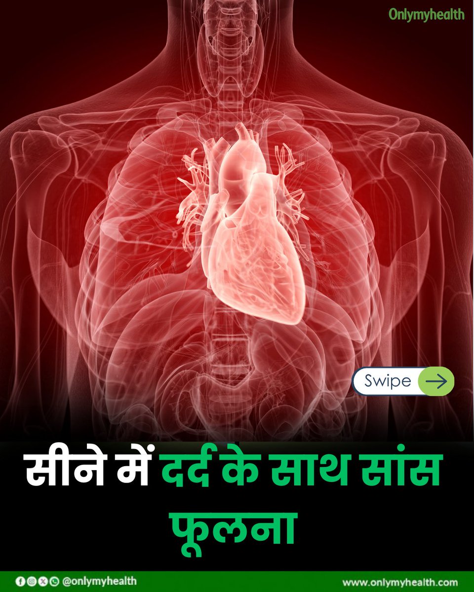 onlymyhealth's tweet image. 🏋️‍♂️ एक्सरसाइज के दौरान सांस फूलना – सामान्‍य या खतरे की घंटी? 🚨

❗ कब हो सकती है यह चिंता की बात?
✅ अचानक और तेज सांस फूलना
✅ सीने में दर्द के साथ सांस फूलना
✅ चक्कर आना और कमजोरी
✅ लंबे समय तक सांस फूलने की समस्या
✅ रात में सोते समय सांस फूलना

#HealthFirst #WorkoutTips