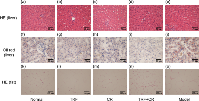 NutritionBMC's tweet image. In #Nutrition & #Metabolism
🔎Investigating the effects of time-restricted feeding and caloric restriction in metabolic associated fatty #LiverDisease in rats🐀
📢4h TRF can improve MAFLD, and there is no need to excessively restrict food intake⏲️
👉doi.org/n7s3