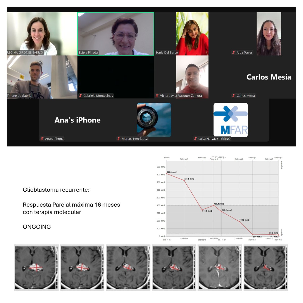 Esta semana nos hemos reunido en nuestro Comité mensual de #neurooncologia `Compartiendo y aprendiendo juntos´, para analizar casos complejos o poco frecuentes, intercambiar conocimiento y proponer diferentes opciones diagnóstico-terapéuticas. ¡Sigamos avanzando! <a href="/GrupoGeino/">GEINO</a>