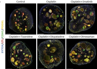 High-throughput drug screening is vital for drug discovery, but 2D cell cultures fall short. Enter organoids: 3D constructs mimicking human organs. Do you want to know more? Read here: ow.ly/Wxsc50V1nqX #3Dimaging