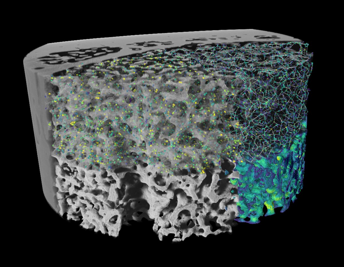 GruiformAbi's tweet image. 🚨 My first PhD paper is out! 🚨
In it we characterise the 3D structure of medullary bone, a type of bone tissue found only in female birds and (possibly) non-bird dinosaurs.
Read about it here: sciencedirect.com/science/articl…