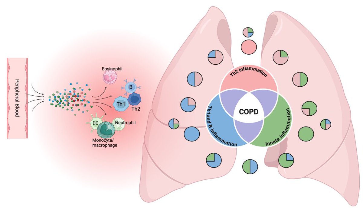 In our latest editorial <a href="/meilan_han/">MeiLan Han</a> and I dive into the significance of eosinophils as a surrogate marker for inflammation in COPD. #COPD #Inflammation
<a href="/ERSpublications/">ERS publications</a> 

Link here: publications.ersnet.org/content/erj/ea…
