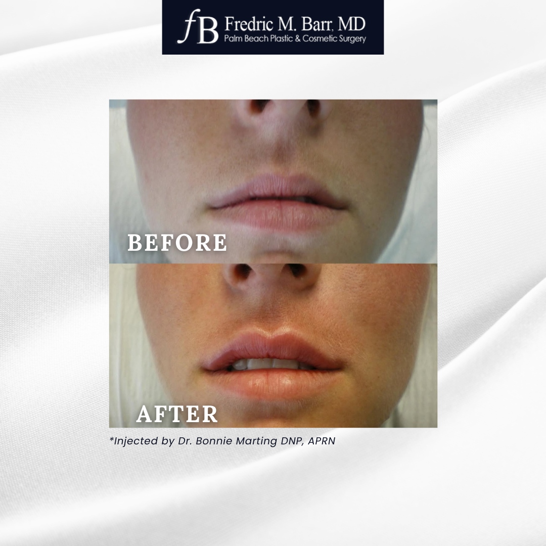 Palm Beach Plastic Surgery tweet media