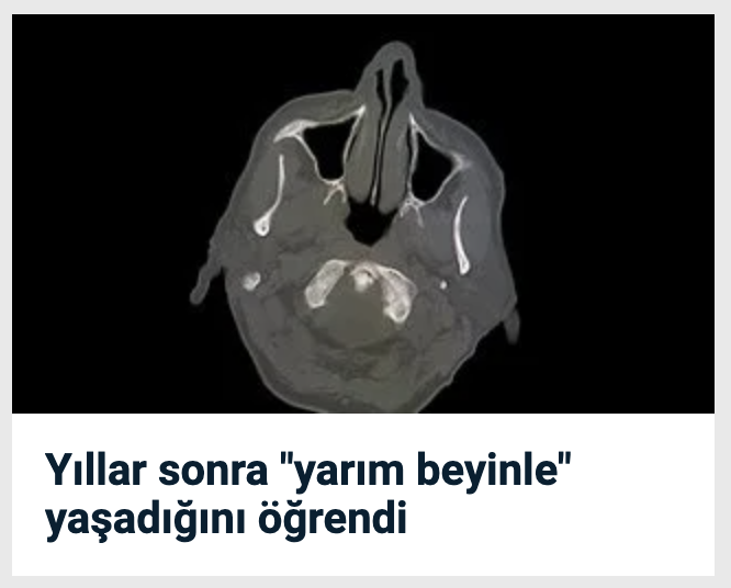 Şüphelendiğin arkadaşını etiketle
