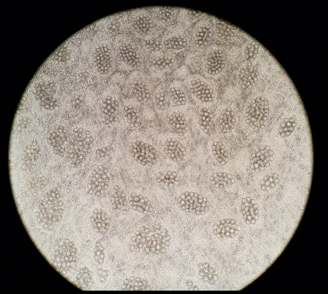 Dipylidium caninum ova packets from a canine fecal float. This tapeworm of the small intestines has an indirect lifecycle with fleas, and possibly chewing lice as intermediate hosts #parasites #parasitology #microbiology #microscopy #vettech #scientist #STEM #DVM #biology