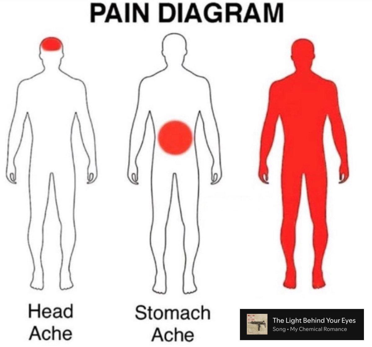 gorebugs's tweet photo. https://t.co/2oNKTzh3uM