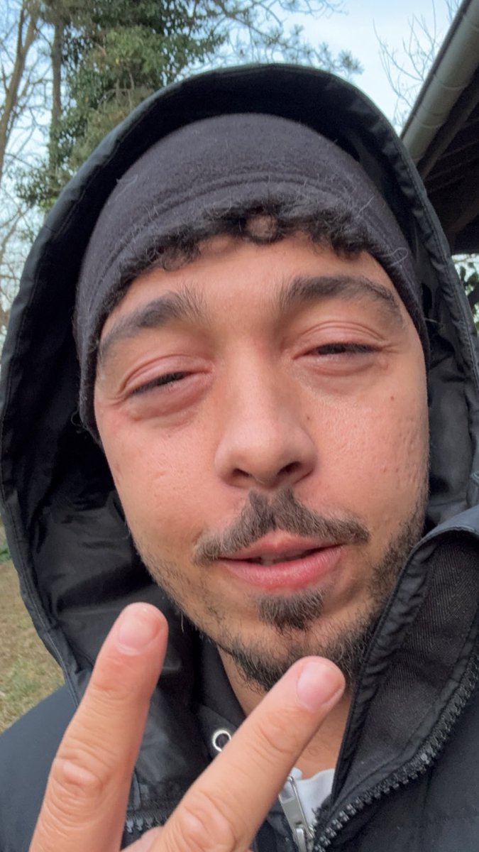 j’ai fais une crise d’allergie, wAllah maman pourquoi tu m’a fais si faible comme ça