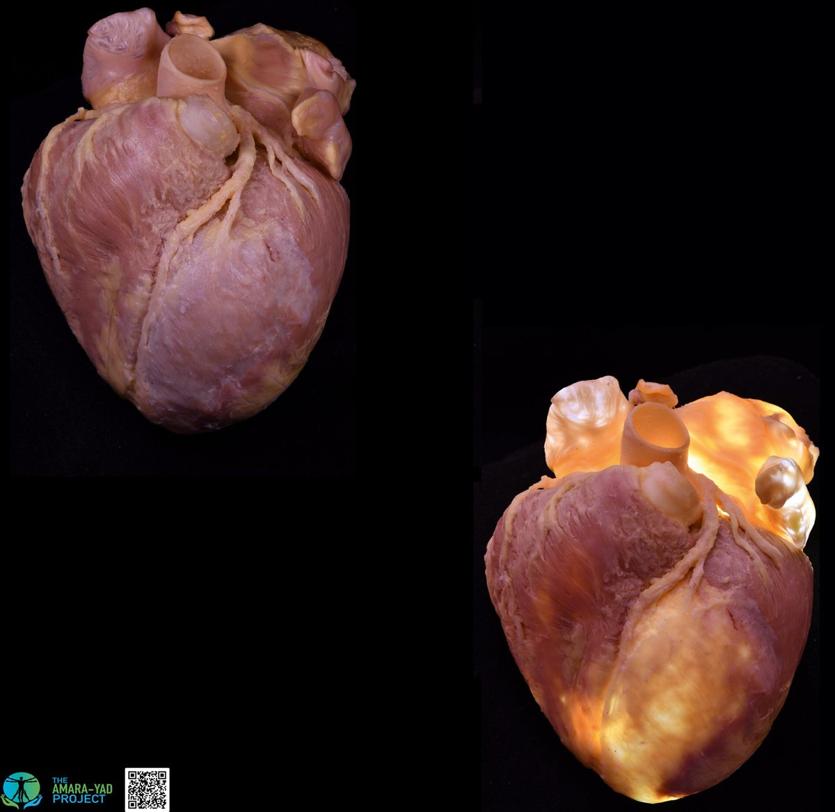 JACC Journals tweet media