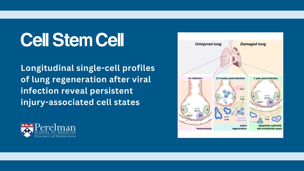Penn Medicine CSO (@pennmedcso) on Twitter photo ft. <a href="/tniethamer/">Terren Niethamer</a>, <a href="/JoePlaner/">Joe Planer</a>, Michael Morley, <a href="/apoorva_babu/">Apoorva Babu</a>, <a href="/zhao_gan/">Gan Zhao</a>, <a href="/MariaCBasil/">Maria C. Basil</a>, Edward Cantu, David Frank, Joshua Diamond, Ana Nottingham, Shanru Li, Hannah Hallquist, Lillian Levin, Su Zhou, <a href="/vaughandy/">Andy Vaughan also on bluesky</a> & <a href="/MorriseyLab/">MorriseyLab</a> sciencedirect.com/science/articl… ft. <a href="/tniethamer/">Terren Niethamer</a>, <a href="/JoePlaner/">Joe Planer</a>, Michael Morley, <a href="/apoorva_babu/">Apoorva Babu</a>, <a href="/zhao_gan/">Gan Zhao</a>, <a href="/MariaCBasil/">Maria C. Basil</a>, Edward Cantu, David Frank, Joshua Diamond, Ana Nottingham, Shanru Li, Hannah Hallquist, Lillian Levin, Su Zhou, <a href="/vaughandy/">Andy Vaughan also on bluesky</a> & <a href="/MorriseyLab/">MorriseyLab</a> sciencedirect.com/science/articl…