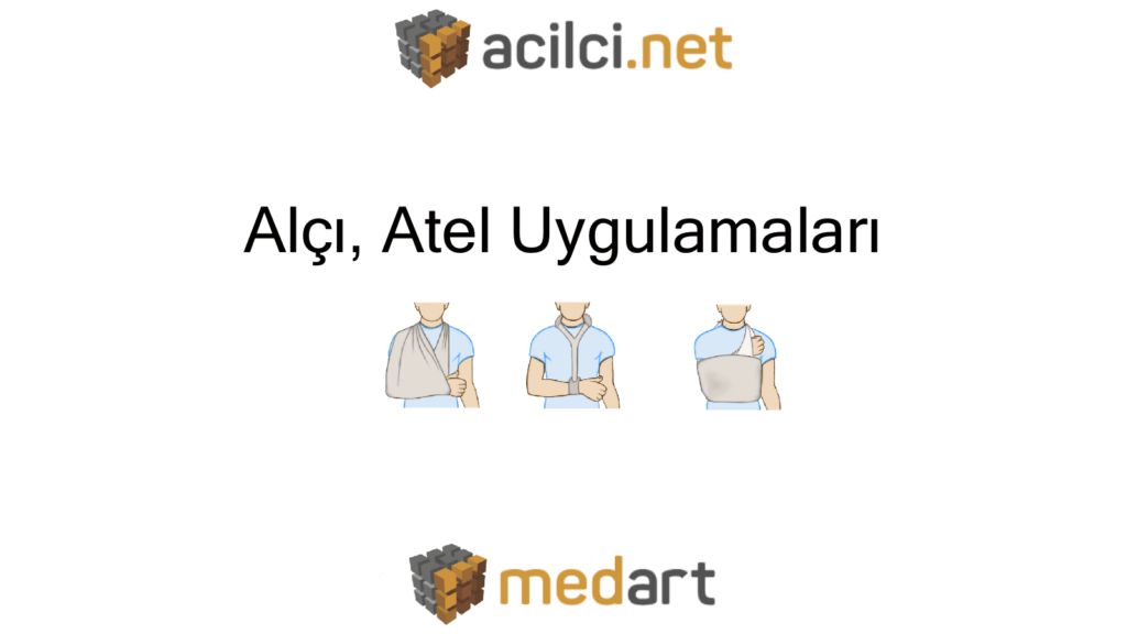 acilci_net's tweet photo. Alçı, Atel Uygulamaları
Murat Yazıcı @mmurat_yazici @acilci_net için yazdı:
https://t.co/31aqVN8fvn
#FOAMed #alçı #atel #MedArt https://t.co/nrUurZpWze