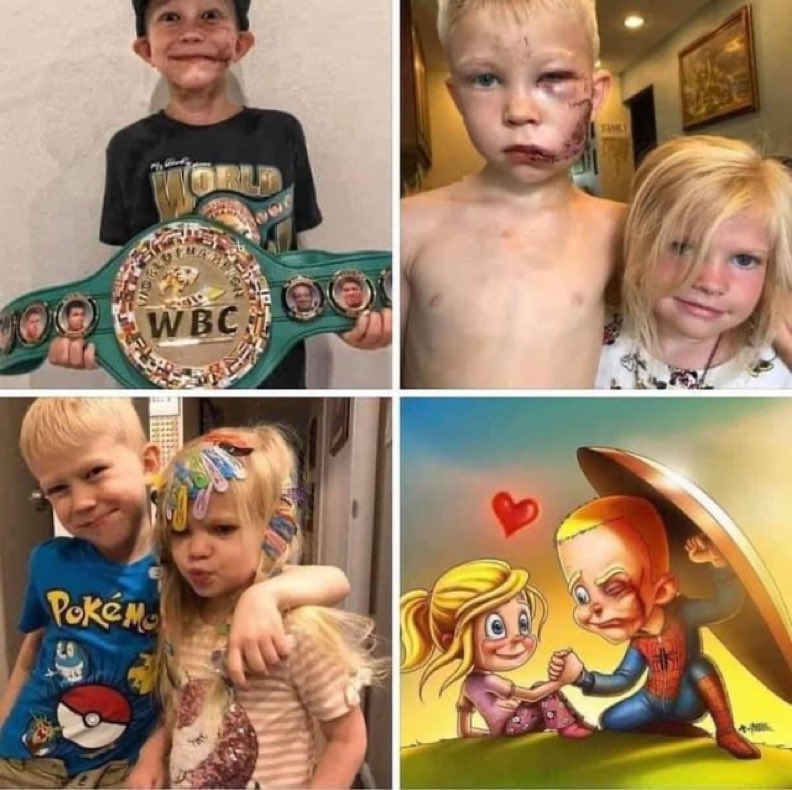 Arteymas_'s tweet photo. El hermano del siglo! El 9 de julio de 2020, Bridger Walker, de seis años, salvó a su hermana pequeña del ataque de un perro. Le dieron 90 puntos en todo el cuerpo, pero salvó a su hermana de tres años de una muerte segura. El Consejo Mundial de Boxeo lo reconoció como campeón mundial a tiempo completo.