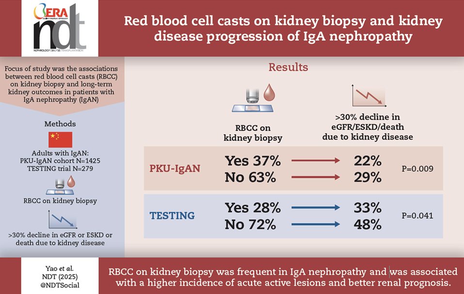 Gunnar Henrik Heine (@gunnar_heine) on Twitter photo Red Blood Cell Casts on Kidney Biopsy are associated with BETTER prognosis of IgA Nephropathy - as they indicate earlier stages of IgANP ?
academic.oup.com/ndt/article-ab…
<a href="/NDTsocial/">NDT</a> <a href="/hjanders_hans/">Hans-Joachim Anders</a> <a href="/AKronbichler/">Andreas Kronbichler</a> <a href="/IgAN_JBarratt/">Jonathan Barratt</a> Red Blood Cell Casts on Kidney Biopsy are associated with BETTER prognosis of IgA Nephropathy - as they indicate earlier stages of IgANP ?
academic.oup.com/ndt/article-ab…
<a href="/NDTsocial/">NDT</a> <a href="/hjanders_hans/">Hans-Joachim Anders</a> <a href="/AKronbichler/">Andreas Kronbichler</a> <a href="/IgAN_JBarratt/">Jonathan Barratt</a>