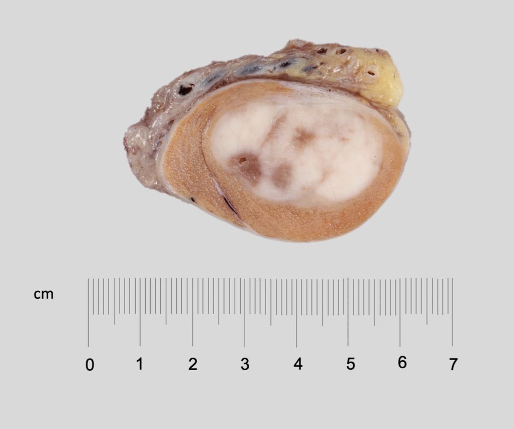 Katrina Collins, MD || Pathologist tweet media