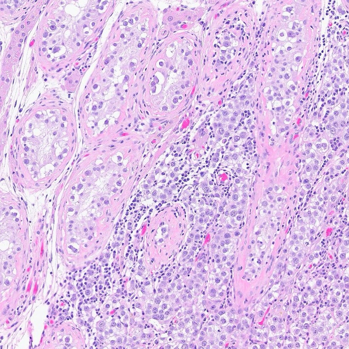 Katrina Collins, MD || Pathologist tweet media