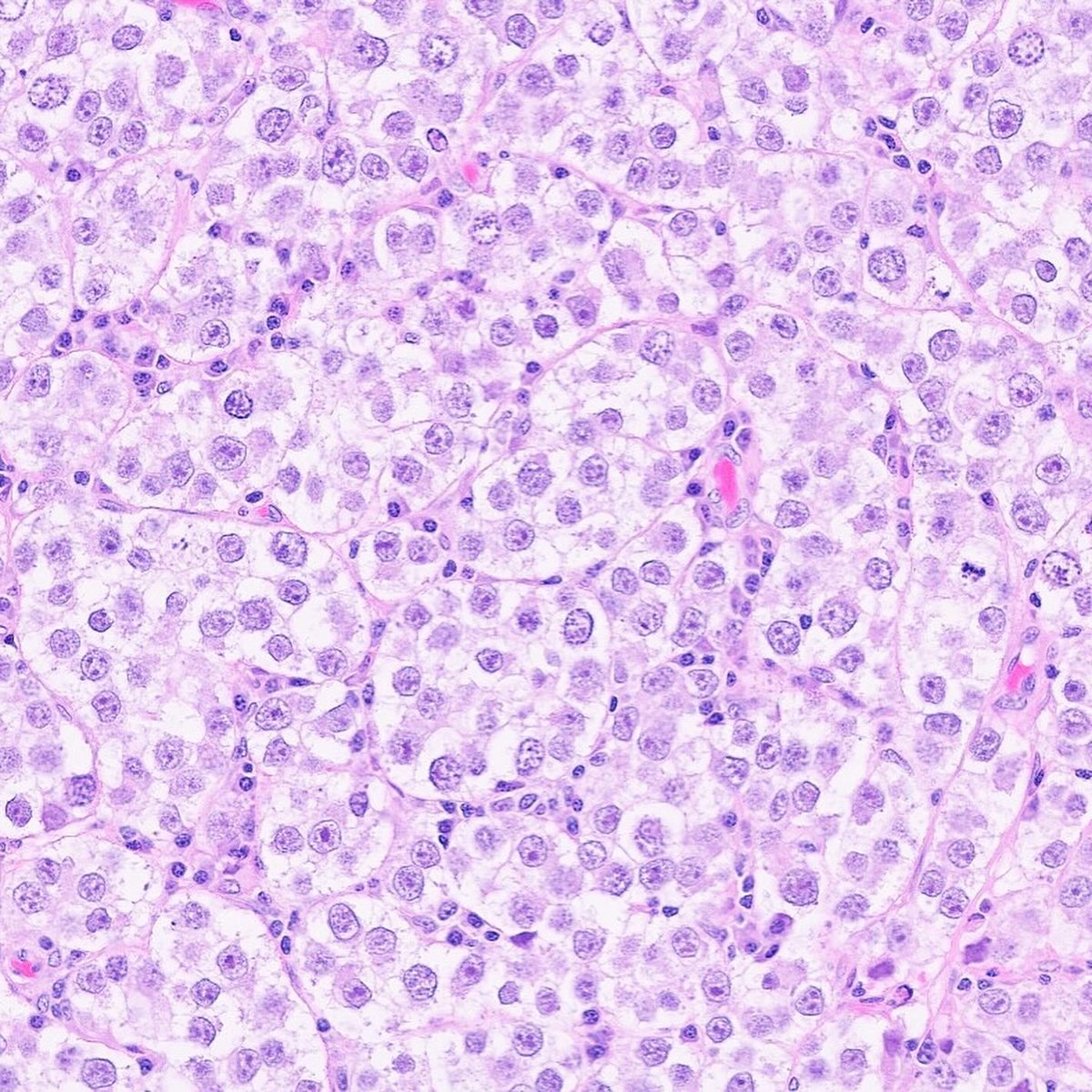 Katrina Collins, MD || Pathologist tweet media