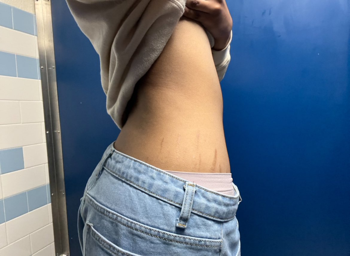 xhlstpl's tweet photo. bmi 20s ill be back !!!!!! https://t.co/I9Eo2iAAiL