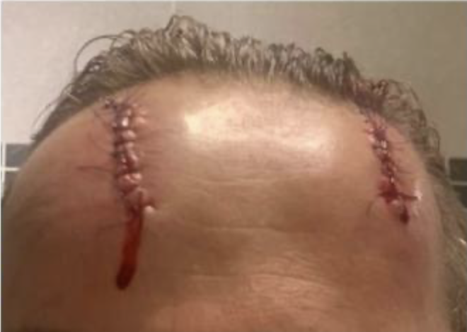 In #Trentino un gruppo di #ultras del #Trento ha massacrato a calci e pugni una #poliziotta perché #transgender . Restiamo in attesa della condanna di chi #iostoconleforzedellordine