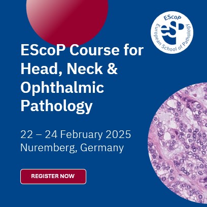 ESP_Pathology's tweet photo. 🎉We are in Nuremberg for an #EScoP course: Head, Neck, and Ophthalmic #pathology!

Day 1⃣ had a brilliant start, with more than 100 colleagues joining us from early in the morning to enjoy the lectures from the 4 Faculty!
#PathTwitter #PathX #Education https://t.co/YRFAu4mX36