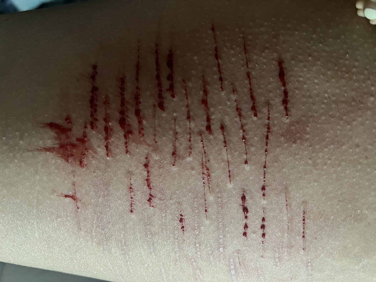 deadddddecct's tweet photo. pics from tonites 🩸sesh! (sfx/fake blood/fake body) https://t.co/qHsLUlCQIp