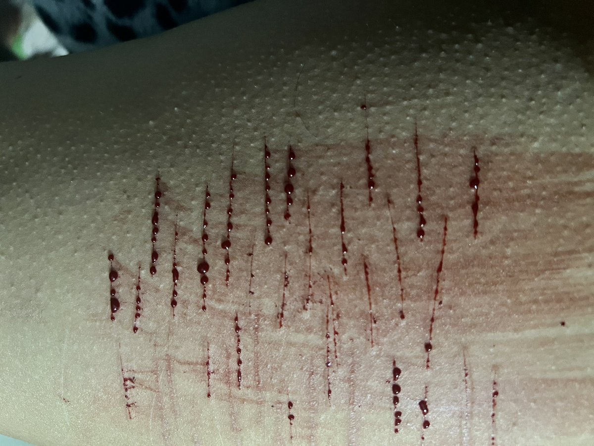 deadddddecct's tweet photo. pics from tonites 🩸sesh! (sfx/fake blood/fake body) https://t.co/qHsLUlCQIp