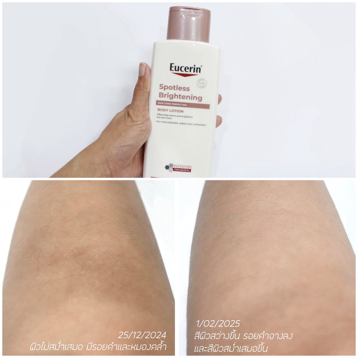 บอกต่อ โลชั่น ที่ใช้อยู่ช่วงนี้ แล้วผิวสว่างขึ้นจริง Spotless Body Lotion ตัวนี้เลย เค้ามีสารไทอามิดอล สารไบรท์เทนนิ่งตัวดังที่ช่วยยับยั้งรอยดำที่ต้นตอ เราใช้มาตอนนี้ได้ 1 เดือน จากผิวที่ดูหมองคล้ำ มีรอยดำกร้าน ตรงหน้าขา  ดูสว่างสม่ำเสมอ สีผิวเท่ากันแล้ว ผิวยังชุ่มชื่นขึ้นด้วย ทาแล้วซึมไวไม่เหนอะหนะ  เราเอามาทาก้นด้วย ตอนนี้รู้สึกก้นใสขึ้นมาอีก ชอบ มาก แนะนำเลย

 #ดีต่อใจ #EucerinThailand #โลชั่นผิวขาว #ไทอามิดอลบอดี้โลชั่น