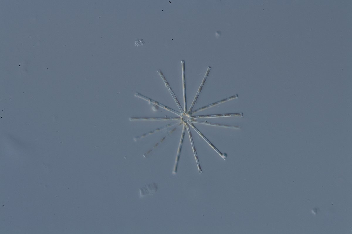 biwahaku's tweet image. ようやくマイクロバーで見られる琵琶湖の #プランクトン が冬の景色になってきました。
#ワムシ のように小型であったり、ホシガタケイソウやオビケイソウのように背景の一部と見間違いそうになったりする生き物も多いですので、ぜひじっくり観察してみてください。
#琵琶湖博物館 #びわ博 #ケイソウ