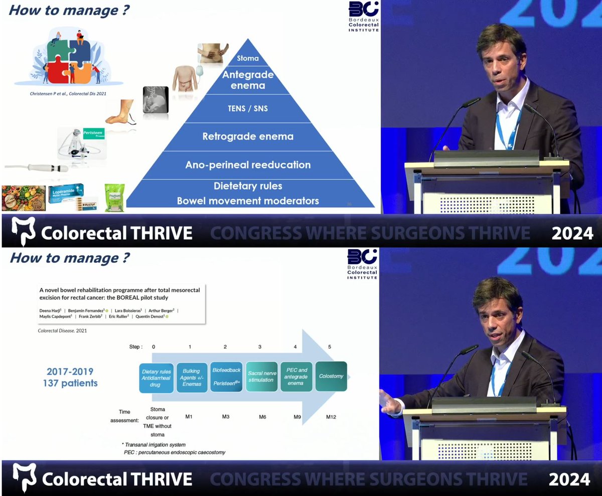 Michel Adamina (@micheladamina) on Twitter photo 🧵2/2
Managing LARS:
- Dietary, enema, neuromodulation, Botox
- Early action prevents permanent stoma
Join us #THRIVE2025 Sun 30.3 - Wed 2.4.2025 to learn more from <a href="/QDenost/">Quentin Denost</a> wisdom:
- Tailored operative strategies and ileostomy policy in locally advanced rectal cancer
- Organ 🧵2/2
Managing LARS:
- Dietary, enema, neuromodulation, Botox
- Early action prevents permanent stoma
Join us #THRIVE2025 Sun 30.3 - Wed 2.4.2025 to learn more from <a href="/QDenost/">Quentin Denost</a> wisdom:
- Tailored operative strategies and ileostomy policy in locally advanced rectal cancer
- Organ