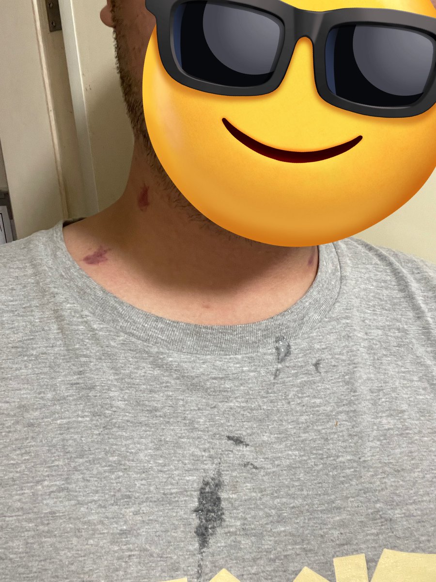 被幹嘴口爆了，滴出來的好浪費啊🥺