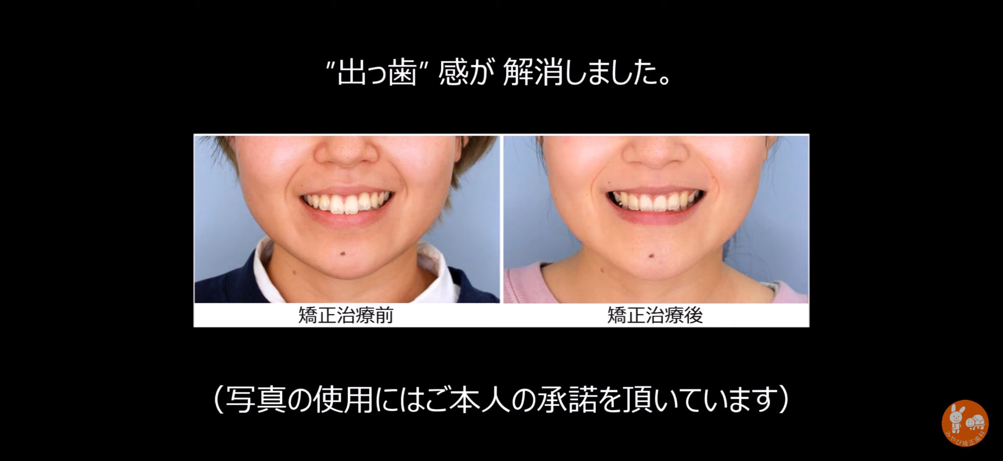プチ矯正のススメ Amazon.co.jp: プチ矯正のススメ : 相原克偉: 本