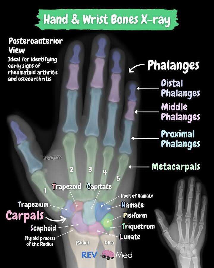 youngmudez29474's tweet image. X-rays for days. She Looks Too Pretty Try To Catch Her 😅 iykyk

#Medthreads
