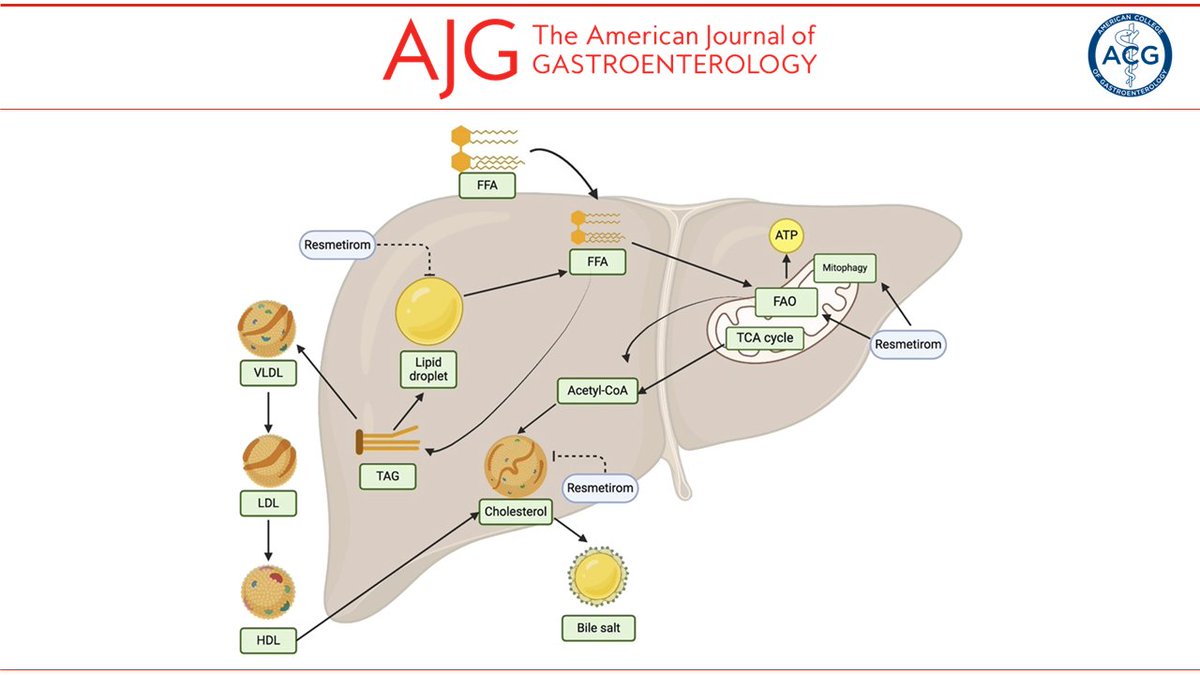 AJG - The American Journal of Gastroenterology (@amjgastro) on Twitter photo In the 📕#RedJournal:
Update on Newly Federal Drug Administration-Approved Drug, Resmetirom: A Practical Perspective
A. Sidney Barritt, IV, MD, MSCR, FACG & Jonathan G. Stine, MD, MSc
👉 bit.ly/438oCOq
<a href="/sidbarritt4/">sidbarritt4</a> <a href="/JonathanStineMD/">Jonathan G. Stine, MD MSc, FACP</a> In the 📕#RedJournal:
Update on Newly Federal Drug Administration-Approved Drug, Resmetirom: A Practical Perspective
A. Sidney Barritt, IV, MD, MSCR, FACG & Jonathan G. Stine, MD, MSc
👉 bit.ly/438oCOq
<a href="/sidbarritt4/">sidbarritt4</a> <a href="/JonathanStineMD/">Jonathan G. Stine, MD MSc, FACP</a>