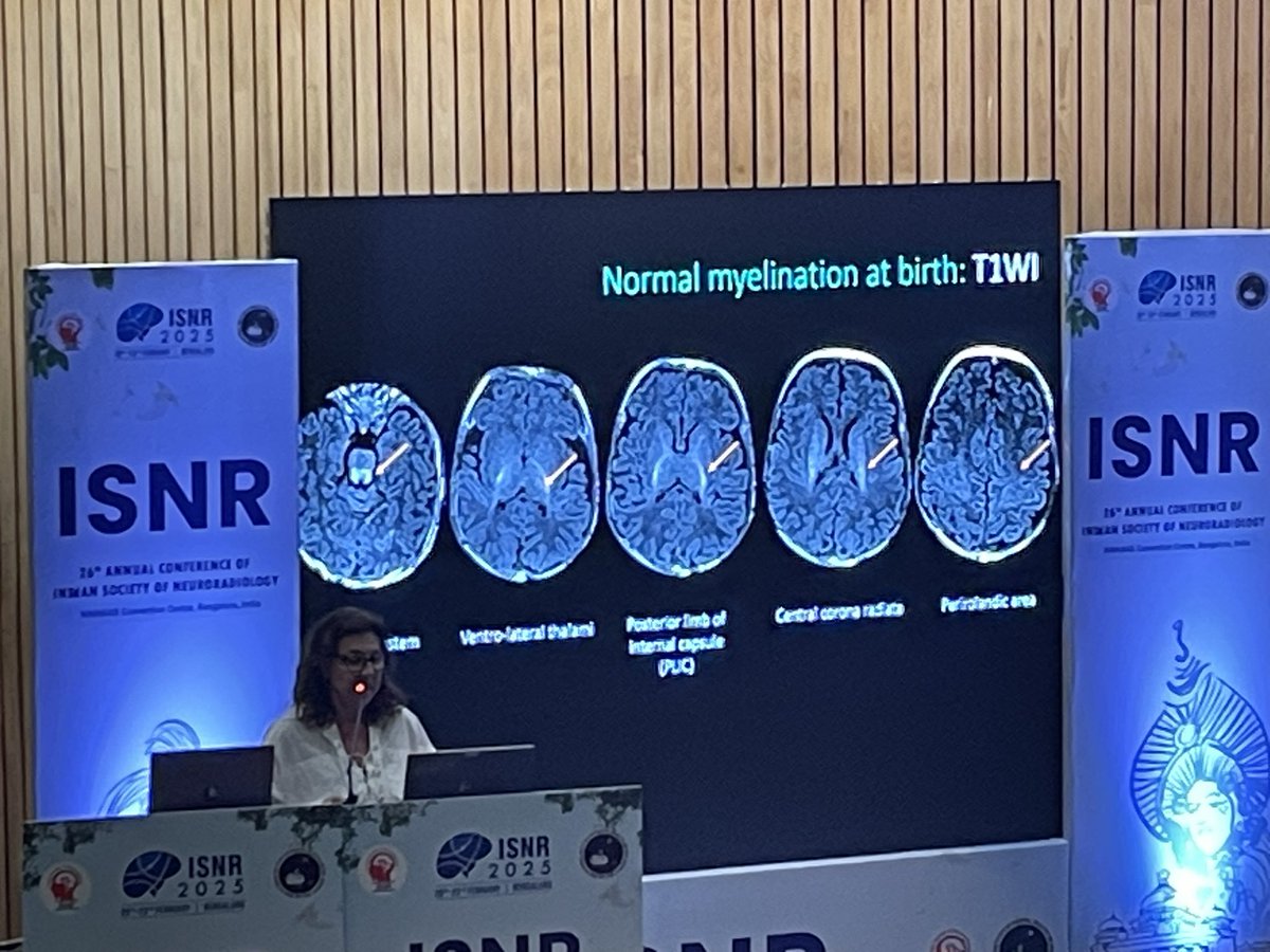 Swetha_MNair's tweet photo. An exciting @isnr_2025! Brilliant talks by @DrArpitaSahu @drbejoy2002.
Wonderful review of neonatal brain imaging by @SusanPalasis madam.
Thankyou to the lovely @SabhaAhmed03 madam and NIMHANS for a brilliantly organised conference! https://t.co/ablKDFOI52