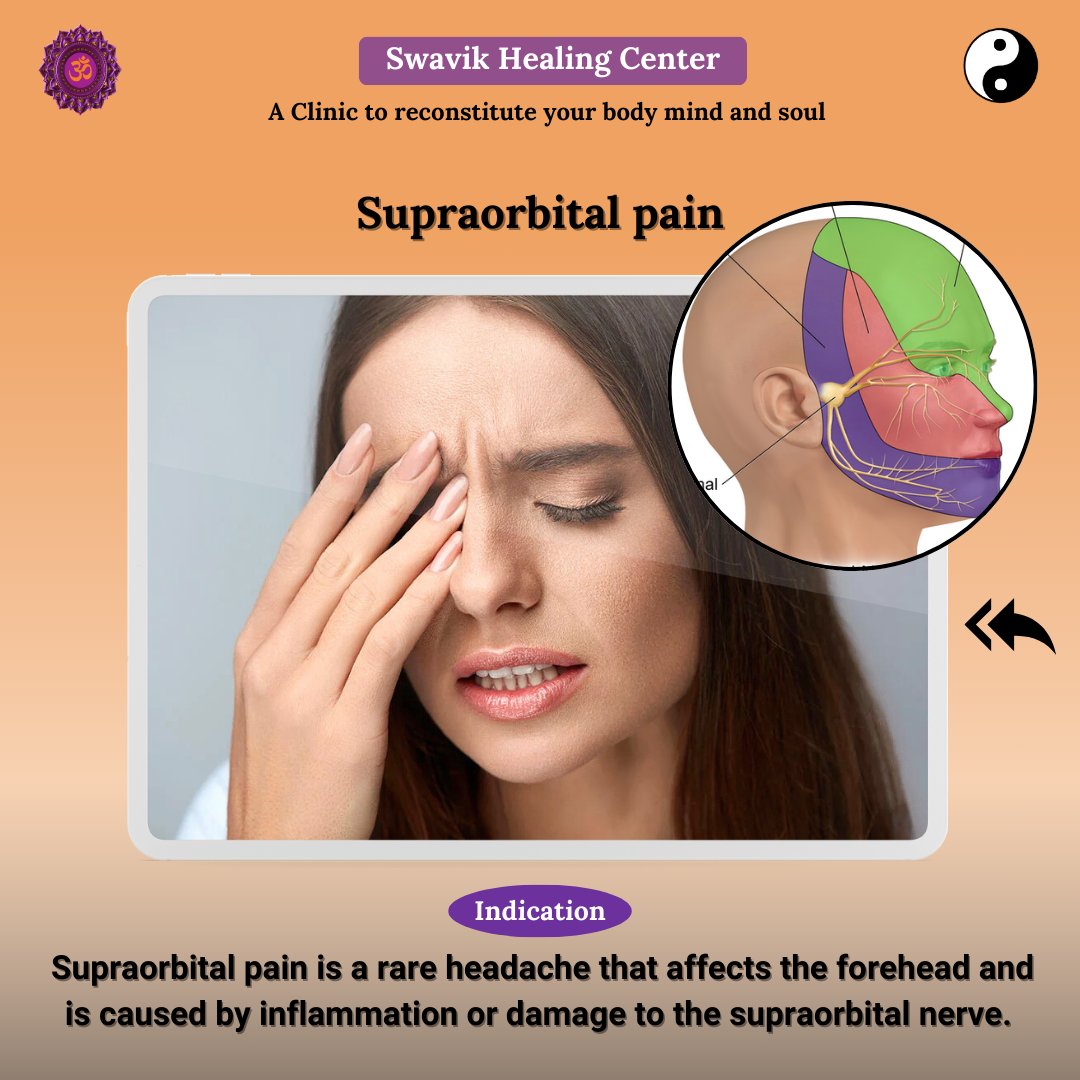 SwavikHealing's tweet photo. ☯Supraorbital pain is a rare headache that affects the forehead and is caused by inflammation or damage to the supraorbital nerve.
 #acupunturetherapy #acupressure #cuppingtherapy #gurugramcity #palamvihar #sinuspain #sinus #backsprain #supraorbitalpain #supraorbital #lowback https://t.co/UfqfuGigfE