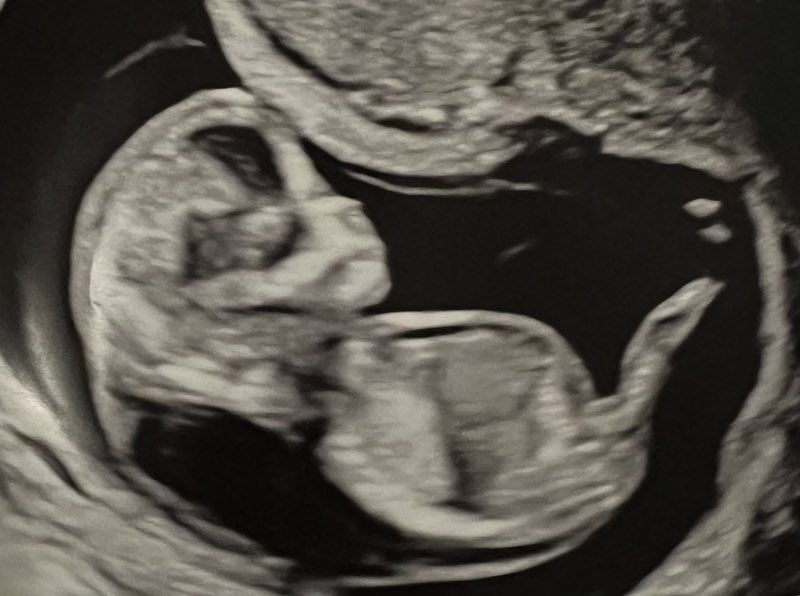 After legislators in Campeche, Mexico, decided to decriminalize abortion, Bishop José Francisco Gonzalez announced that Catholics involved in or advocating for abortion will be excommunicated.

Follow: <a href="/AFpost/">AF Post</a>