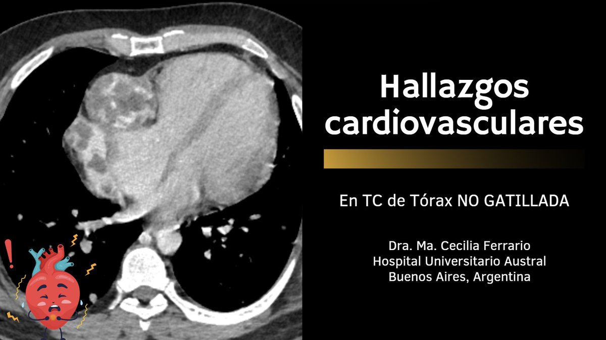 Dra. Cecilia Ferrario (@draceciferrario) on Twitter photo Increíble plan para todos los hispanohablantes que amamos la radiología torácica 🫁🤍🤓
Este lunes nos encontramos en el webinar gratuito en español de la <a href="/thoracicrad/">Society of Thoracic Radiology</a> para seguir aprendiendo juntos 💪🏻
Espero verte allí 😊
🔗thoracicrad.org/?page_id=5303
#chestrad #radiology #FOAMrad Increíble plan para todos los hispanohablantes que amamos la radiología torácica 🫁🤍🤓
Este lunes nos encontramos en el webinar gratuito en español de la <a href="/thoracicrad/">Society of Thoracic Radiology</a> para seguir aprendiendo juntos 💪🏻
Espero verte allí 😊
🔗thoracicrad.org/?page_id=5303
#chestrad #radiology #FOAMrad