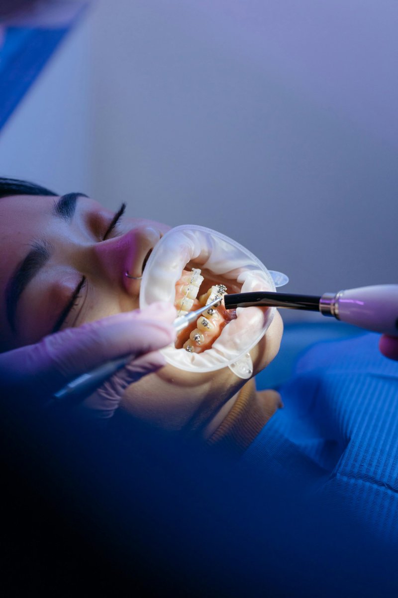 TODO LO QUE DEBES SABER SOBRE BRACKETS TRANSPARENTES: la opción más discreta para tu sonrisa #Salud #Bucodental #Odontologia  blgs.co/K9x-3k
