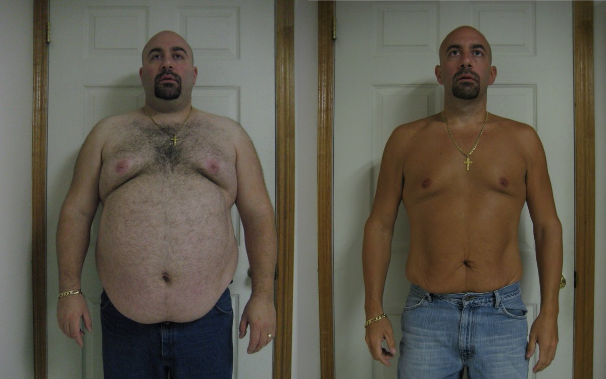 pirrone's tweet photo. My RNY gastric bypass journey.  350lbs - 178lbs.
https://t.co/c5lBGWUpkU https://t.co/IKEDOoYeOJ