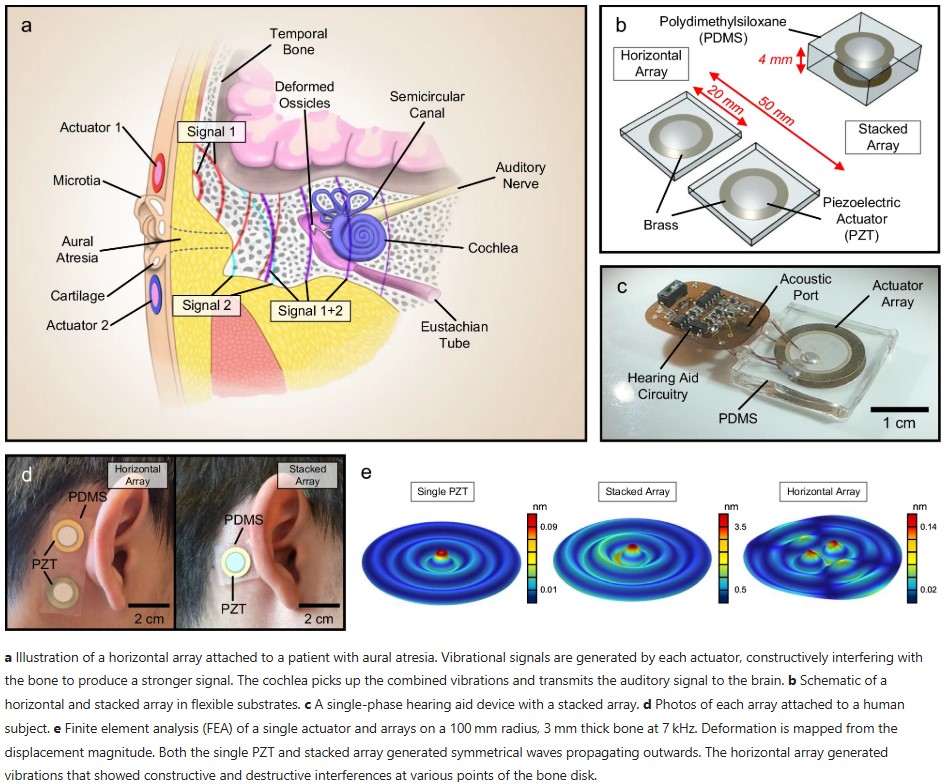 Researchers at are developing flexible hearing aids with micro-epidermal actuators as a noninvasive alternative for children with conductive hearing loss. Could this be a breakthrough for hearing care? 🧵👇